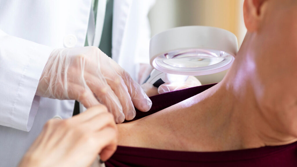 Science Behind Skin Cancer